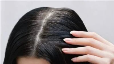 تعب الكبد يظهر في شعرك أولا..احذري هذه العلامات! 	