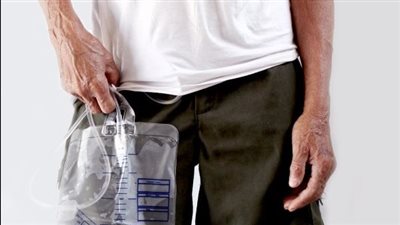 ما حكم صلاة المريض الذي يحمل نجاسة في كيس؟.. الإفتاء تجيب