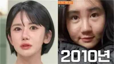 امرأة تنفق أكثر من 200 ألف دولار على 400 عملية تجميل