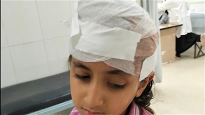 “فين الإشراف؟”.. إصابة تلميذة بشجار مدرسي والأم تتهم المدرسة بالإهمال