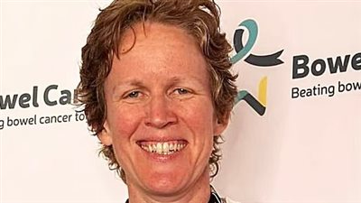 هل يمكن أن يزيد الجري لمسافات طويلة من خطر الإصابة بسرطان القولون؟ دراسة تجيب