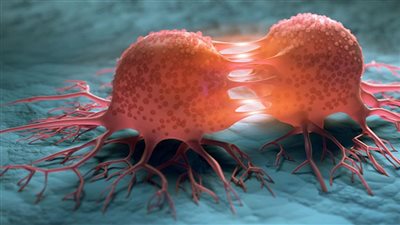 علماء يطورون مستحضرًا من جسيمات الحديد النانوية لعلاج السرطان