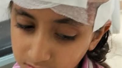 6 غرز.. إصابة طالبة بجروح خلال اليوم الدراسي بالإسكندرية والمديرية تحقق