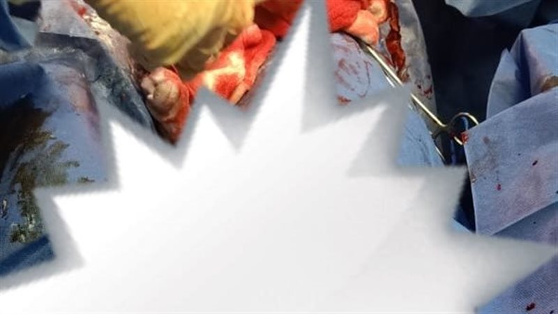 جانب من العمليات