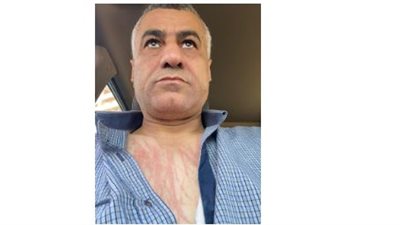 معلم واقعة مدرسة الإبراهيمية يتحدث لـ«نيوز رووم»: المدير ضربني وسط المدرسة