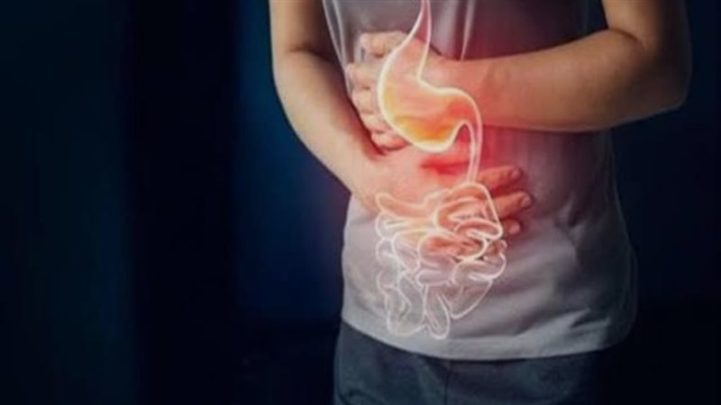 التهاب الأمعاء