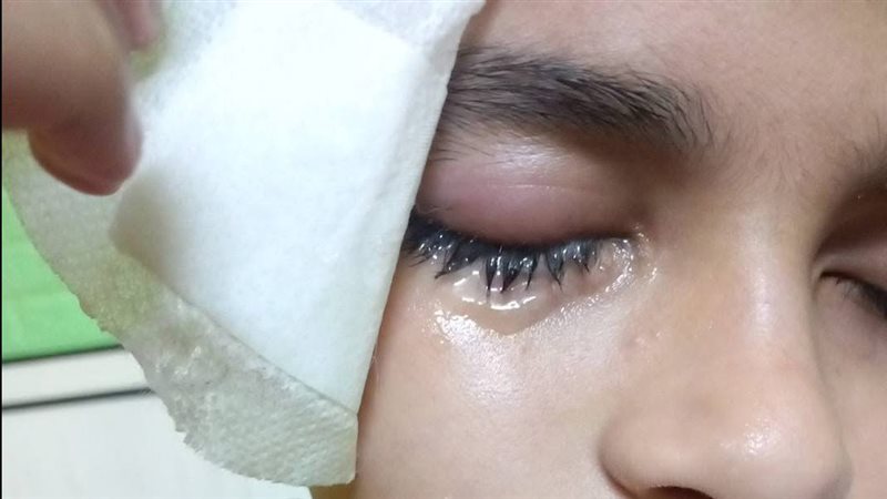 الطالب المصاب 