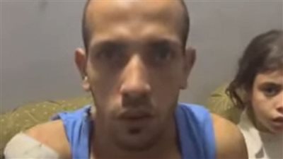 من مصنع الصابون إلى مأساة العمر.. محمد يفقد ذراعه و500 جنيه تعويض الألم