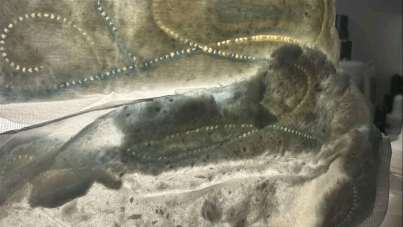 فوط صحية ملوثة