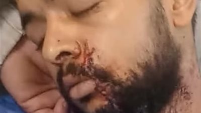 مشاجرة دامية بسبب معاكسة خطيبة شاب في شبين القناطر تنتهي بالشروع في قتل