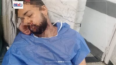 جرح قطعي بالرأس وتهتك باليد.. التقرير الطبي لـ المجني عليه في مشاجرة بشبين 