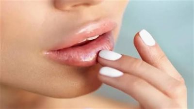 من السكر إلى العسل.. وصفات منزلية تمنحك شفاه وردية ومرطبة 	