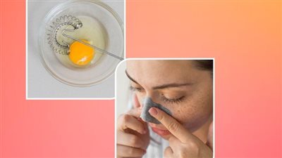 نصائح طبيعية للعناية بالبشرة.. إزالة الرؤوس السوداء ببياض البيض 