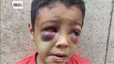 طفل ملثم يعتدي على زميله داخل مدرسة بقفط ويتركه مغشيا عليه
