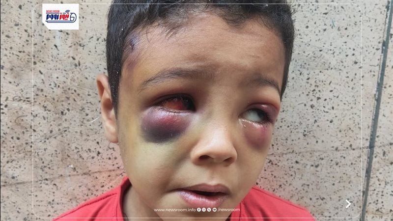 طفل قنا المتعدي عليه