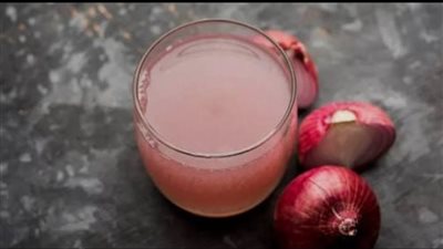 وصفات طبيعية من عصير البصل لنمو الشعر.. مكوناتها متوفرة في بيت 