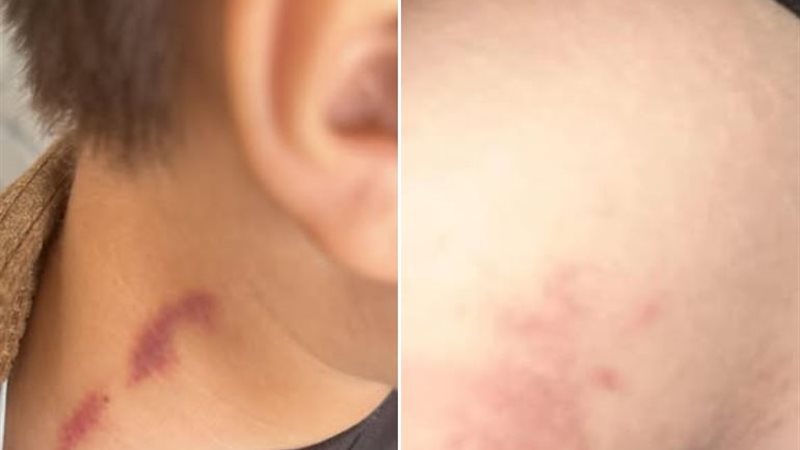 الطفل الضحية 