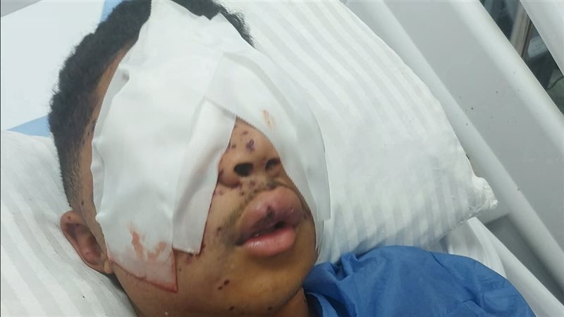 المجني عليه 