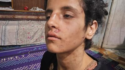 حجزها ف حظيرة مواشي..مأساة طفلة بالمنوفية تعذبت على يد والدها