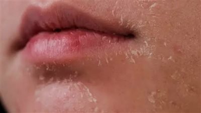 مع اقتراب فصل الشتاء.. 3 خطوات ضرورية لحماية البشرة من الجفاف