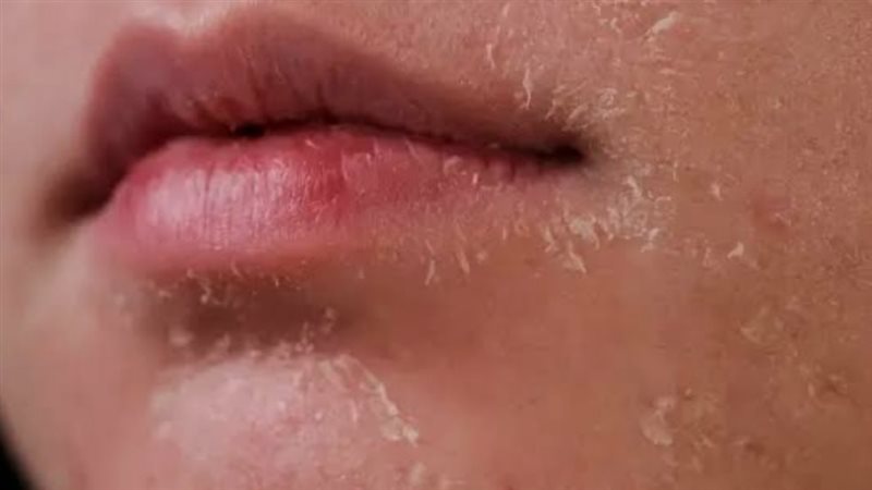 حماية البشرة من الجفاف