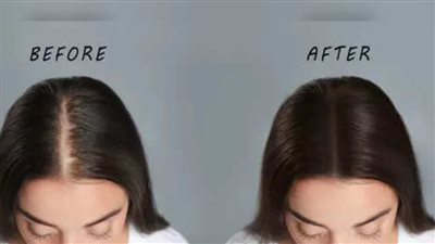 5 عادات سحرية  يمكنها إيقاف تساقط الشعر وتحل مشاكله على الفور