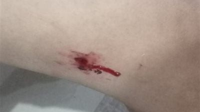 عقرت 59 شخصا..الكلاب الضالة «تغتال» فرحة أهالى السويس بالعيد     