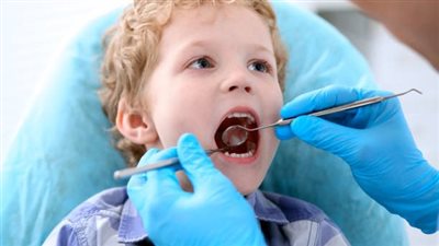 لو ابنك بيحب الحلو.. طبيبة تقدم روشتة للحفاظ على أسنان أطفالنا