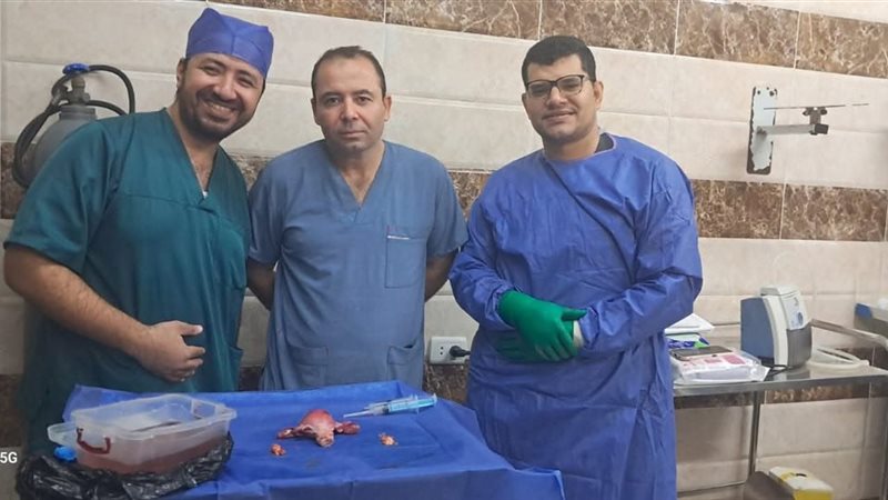 بغض أفراد الفريق