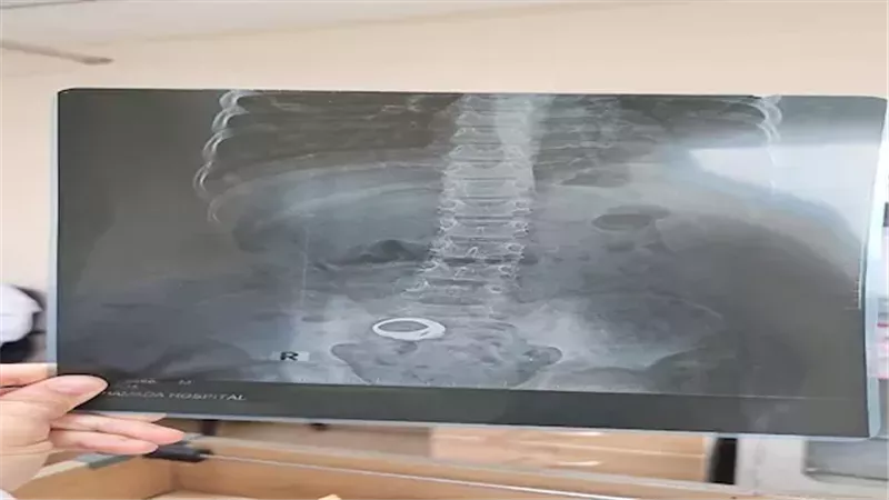 صورة الأشعة