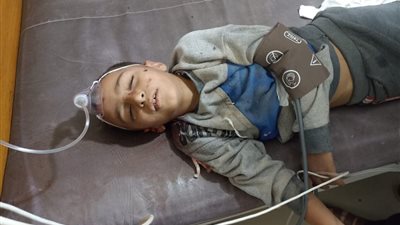 إصابة طفل صدمته سيارة أمام مدرسة بأطفيح والامن يضبط السائق 