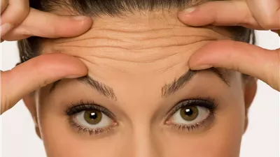 خطوات القضاء على تجاعيد البشرة ..والأطباء يحذرون من الصيحات المبالغ فيها