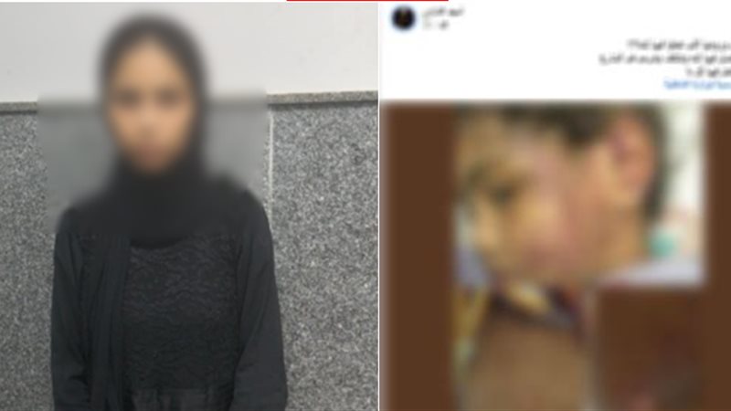 الطفلة المصابة