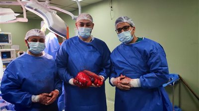 نجاح طاقم طبي بتأمين صحي بنى سويف في إجراء عملية دقيقة لاستئصال ورم سرطاني ضخم