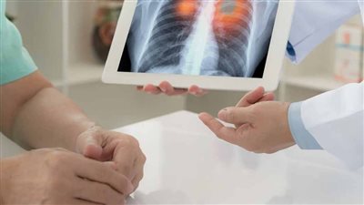 اختراق طبي: تقنية جديدة لإعادة فعالية العلاج الكيميائي ضد خلايا سرطان الرئة