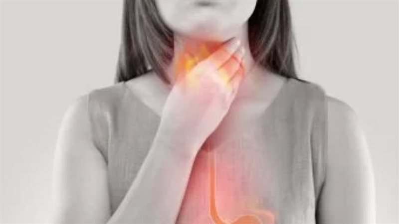 لمرضى الارتجاع