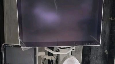 تزويد مستشفى رشيد المركزي بمنظار جراحي حديث لقسم العظام