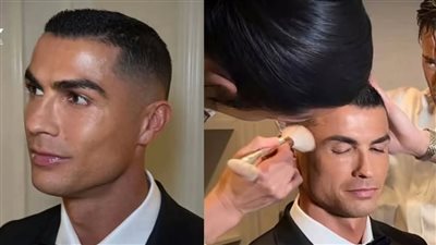 جراح تجميل عالمي: كريستيانو رونالدو خضع للعديد من عمليات التجميل  
