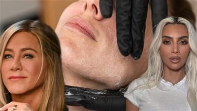 هوس جديد في هوليوود.. ما حقيقة حقن السلمون التي تشعل الجدل؟