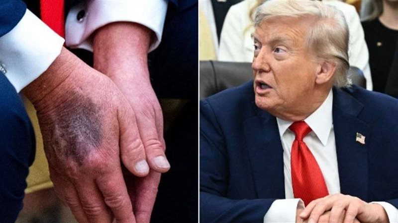 الرئيس الأمريكي دونالد