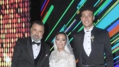 خدوا كام عينة.. ابنة صبحي خليل وزوجة أحمد عبد الوهاب تعلن إجراء عملية في فرنسا