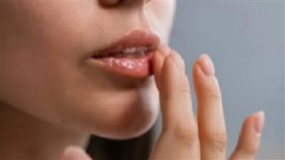 ودّعي التشققات .. زيوت فعالة لترطيب الشفاه في الأجواء الباردة