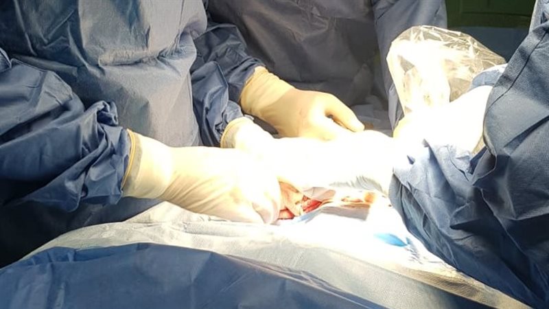 جانب من العملية 