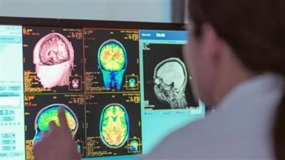 دراسة حديثة تكشف أن مرحلة المراهقة تمتد حتى أوائل الثلاثينيات