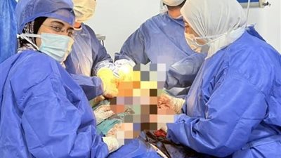 فريق طبي بالبحيرة ينجح في استئصال الرحم والمبيضين لسيدة دون مضاعفات