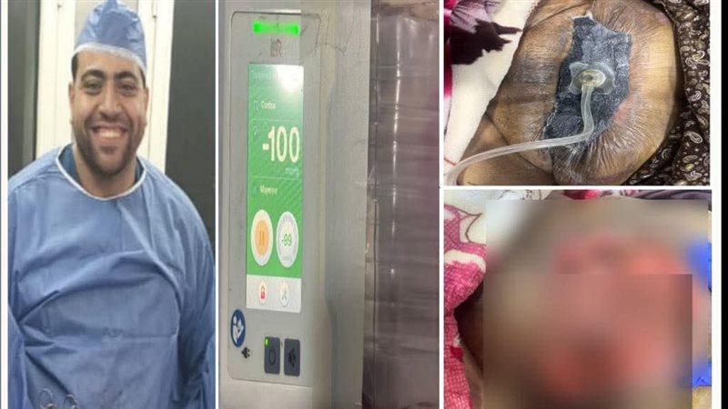 تشغيل جهاز فاكيوم