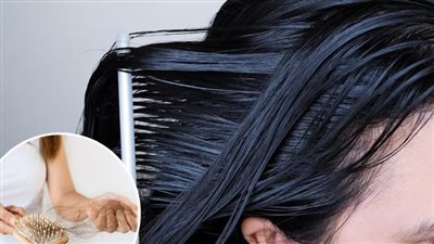 فروة الرأس الدهنية قد تكون مؤشرا على تساقط الشعر في المستقبل