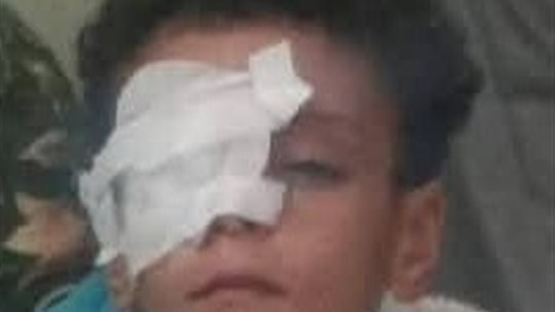 المجنى عليه 