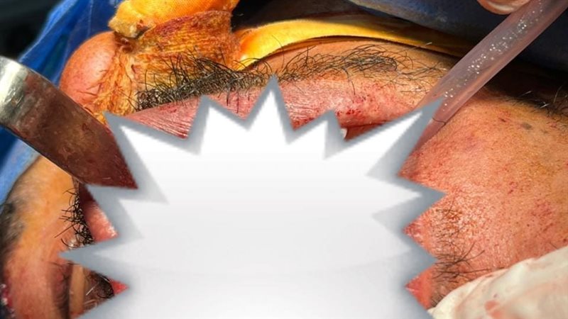 جانب من العمليات