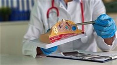 طبيب أورام روسي.. يحذر من خطر عودة الإصابة بسرطان الثدي